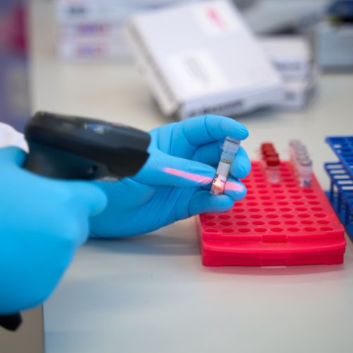 DoxyPEP na onbeschermde seks gebruiken?