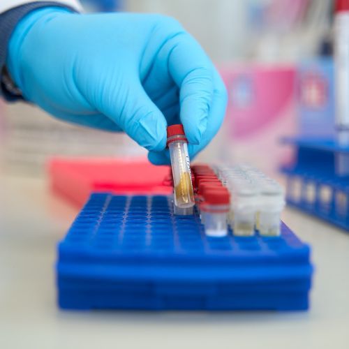 Syfilis of hiv: herken het verloop en de risico’s