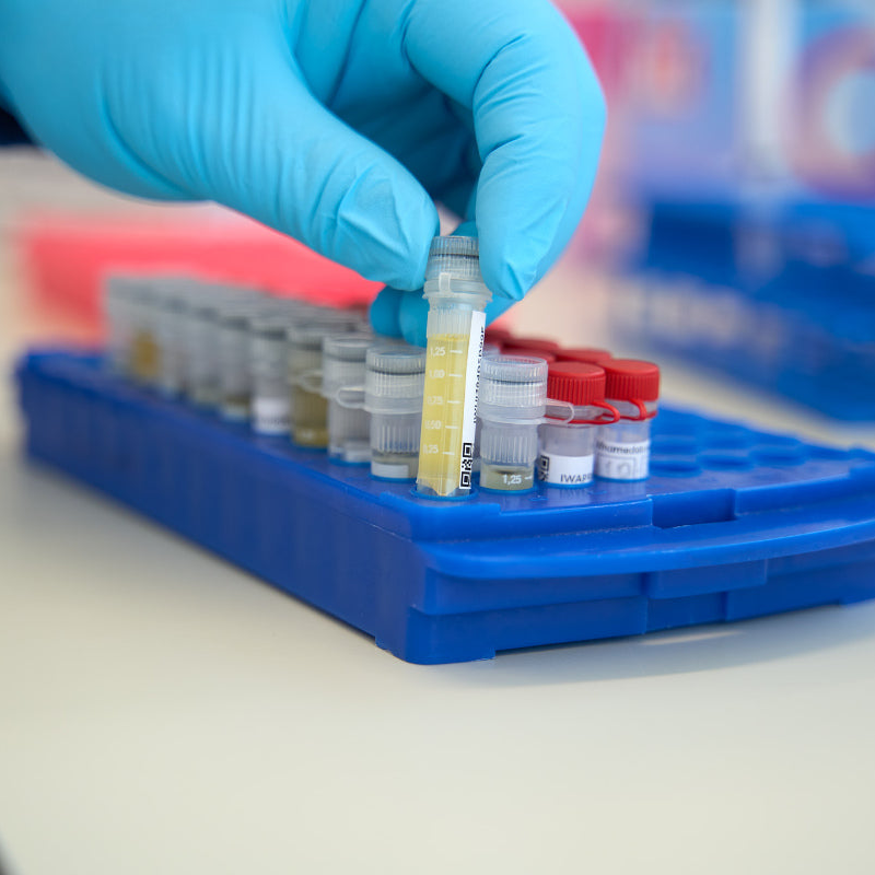 tray met soa test samples in een laboratorium 