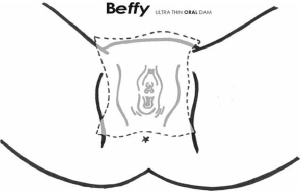 Beffy Liklapjes